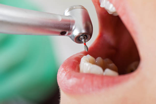 Best Emergency Cosmetic Dentistry (e.g., broken veneers) in Black Creek, WI